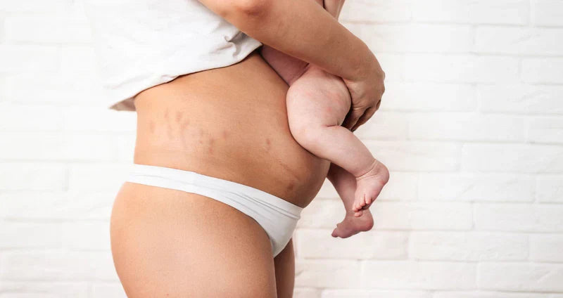 Postpartum Is Not a Diagnosis: Reclaiming the Full Story of Life After Birth